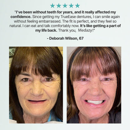 Medazy Custom-Fit Full Functional Dentures